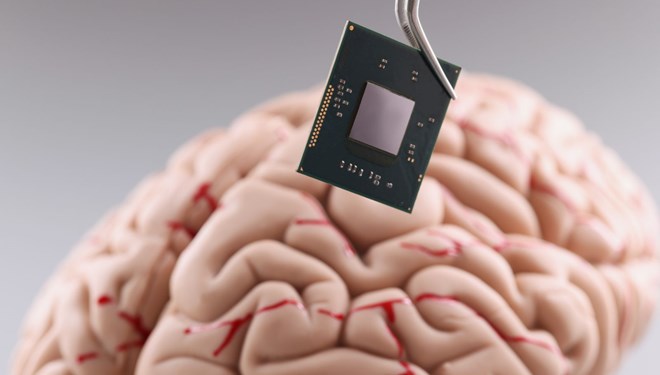  İlon Maskın “Neuralink” şirkəti beyin çipini implantasiya etməyə hazırdır:  Şərtlər müəyyən edilib 
 